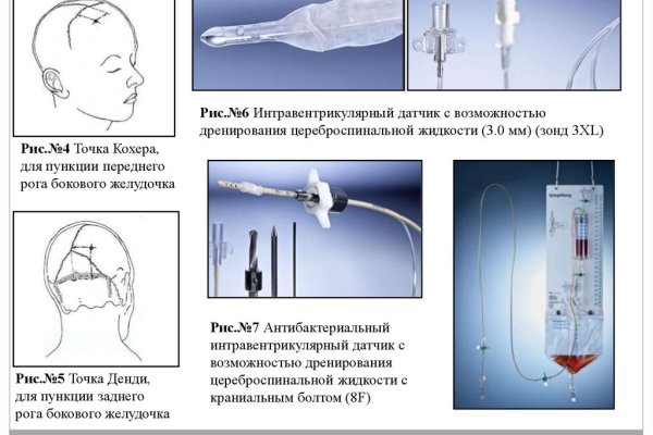 Кракен оф